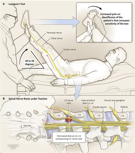 sciatic nerve pain physical exam